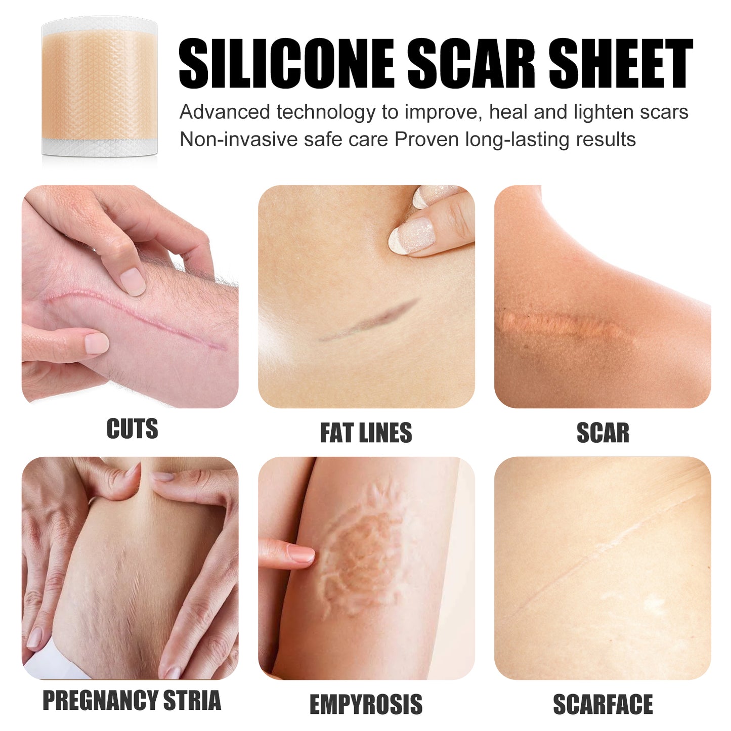 Self-Adhesive Silicone Scar Repair Orange Line Growth Line Smooth Skin Care Beauty Patch